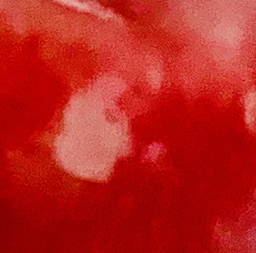 舌が痛い、裏が白い斑点できてる、しみる、治す方法ある？真面目にききたい！