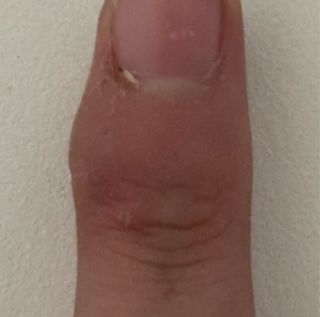 皆さんのペンだこを見して欲しい