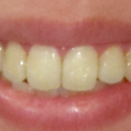 歯茎までごっそり見える