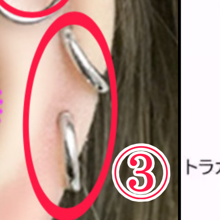 ③ヘリックス（横）