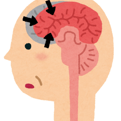 若年性認知症の星